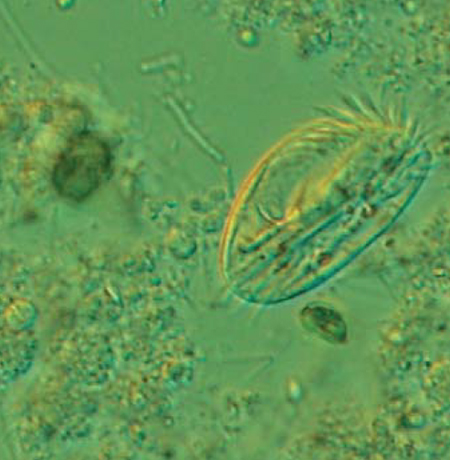 Live protozoa