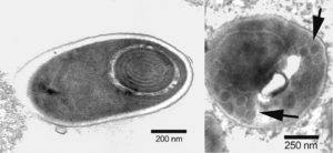 Microsporidian