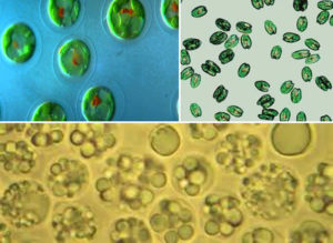 desirable phytoplankton species under a microscope 